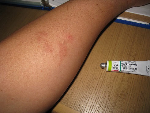 ���b�N�V�b�v�E�J���^�[�r��