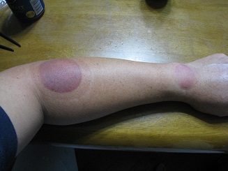 ���b�N�V�b�v�E�J���^�[�r��