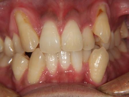 ���c���� �Ȗ؎s�s�����ʂ�C���v�����g�E�z���C�g�j���O�T����