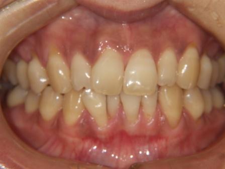 ���c���� �Ȗ؎s�s�����ʂ�C���v�����g�E�z���C�g�j���O�T����