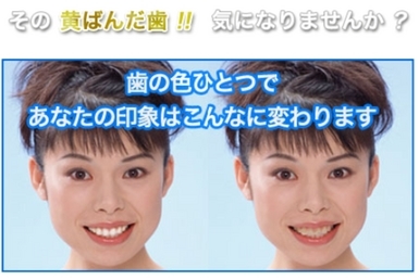 ���c���� �Ȗ؎s�s�����ʂ�C���v�����g�E�z���C�g�j���O�T����