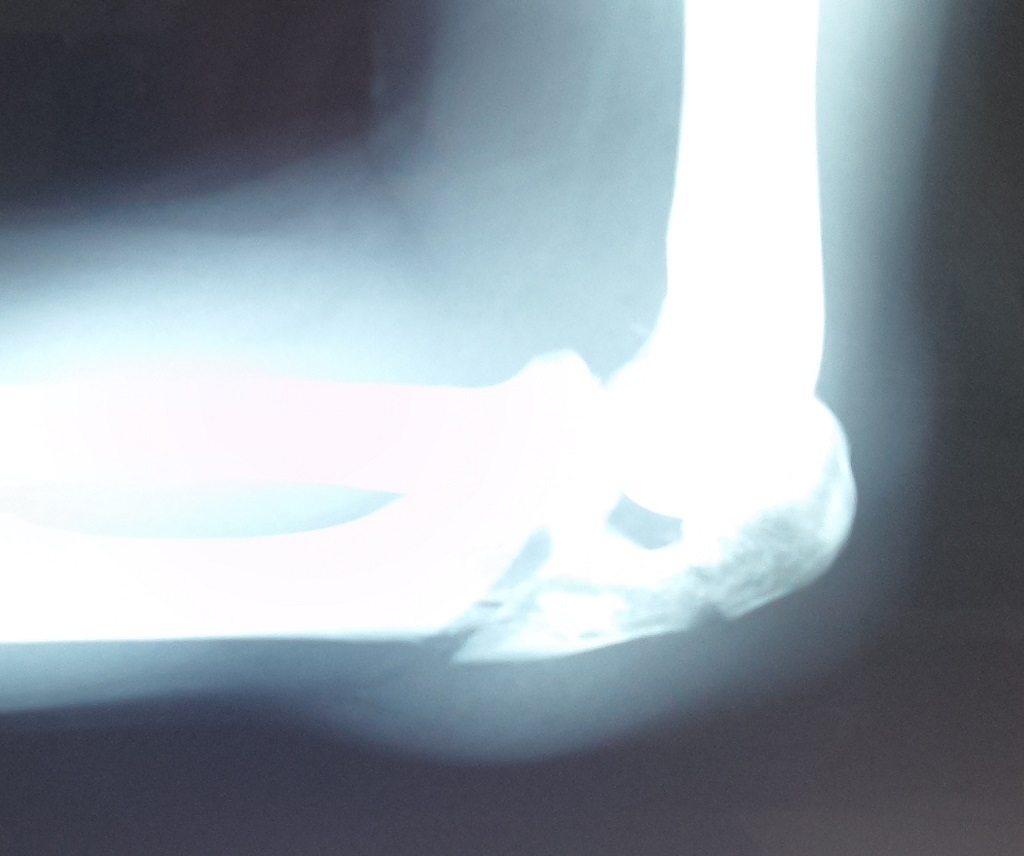 ��M ����֋�blog