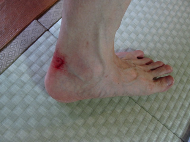 �R�����L