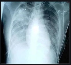 �������тƁ^�y�v�җL�q(�ӂ��키��)