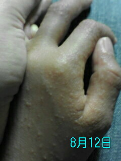 ������������⋆LBH⋆