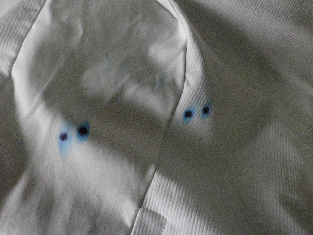 �{�[���y���i���R�s�@�����N���[�j���O�X�j