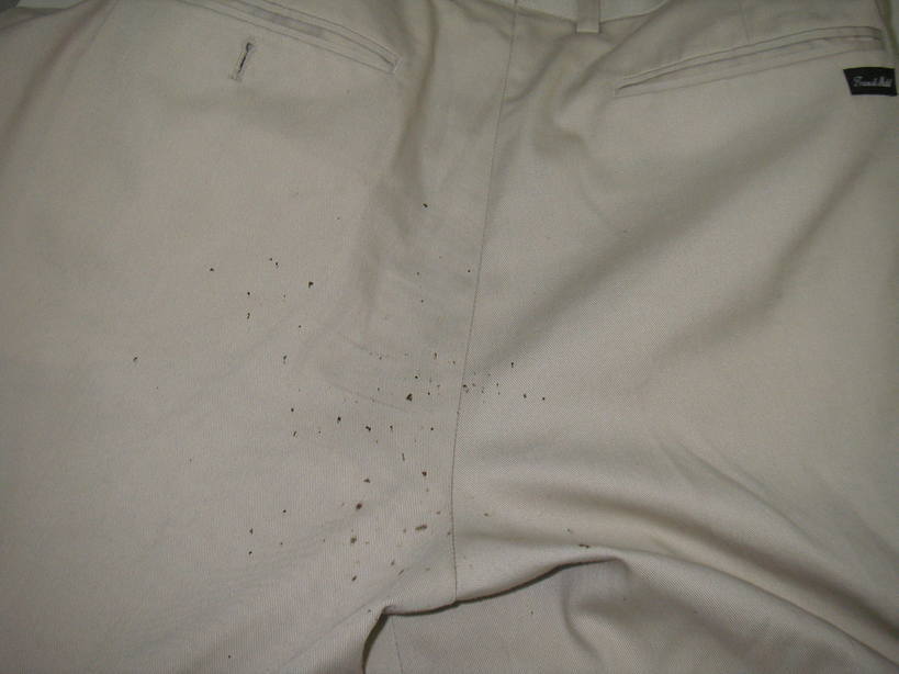 ���R�s�@�����N���[�j���O�X